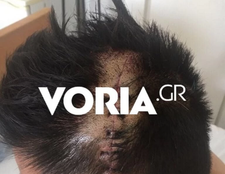 Θεσσαλονίκη: Πανικός και αίμα στην είσοδο εστιατορίου -Αλγερινοί και Σύροι έστησαν ενέδρα σε Κινέζους επιχειρηματίες (βίντεο)